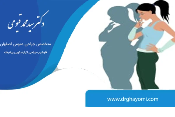 بازگشت وزن بعد از عمل لاغری
