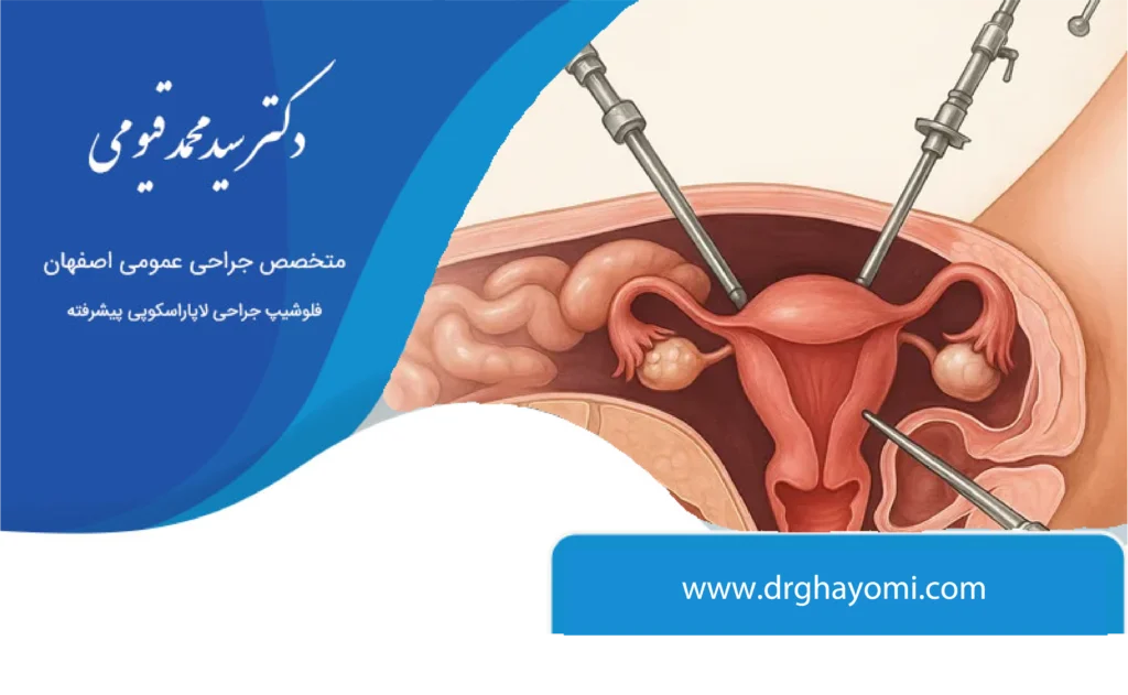 جراحی فتق با لاپاراسکوپی
