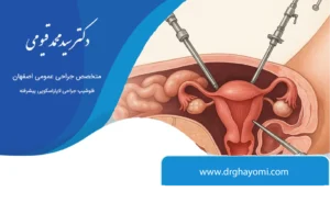 جراحی فتق با لاپاراسکوپی