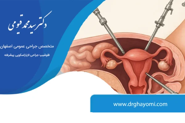 جراحی فتق با لاپاراسکوپی