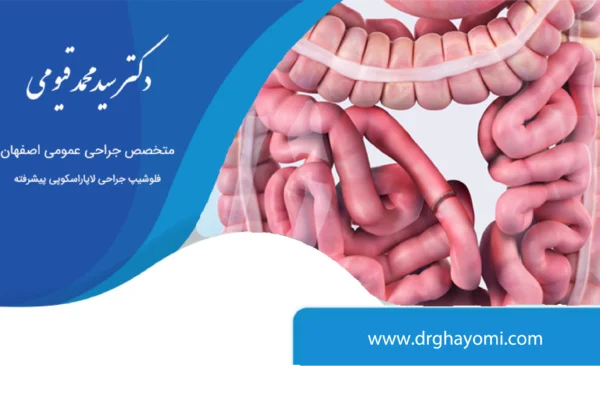 کاهش خطر ابتلا به سرطان روده