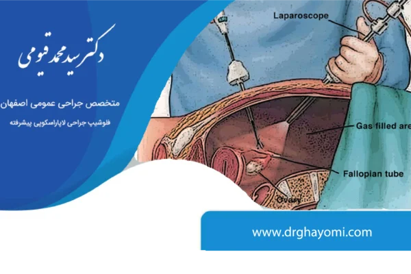 جراحی لاپاراسکوپی و مزایا