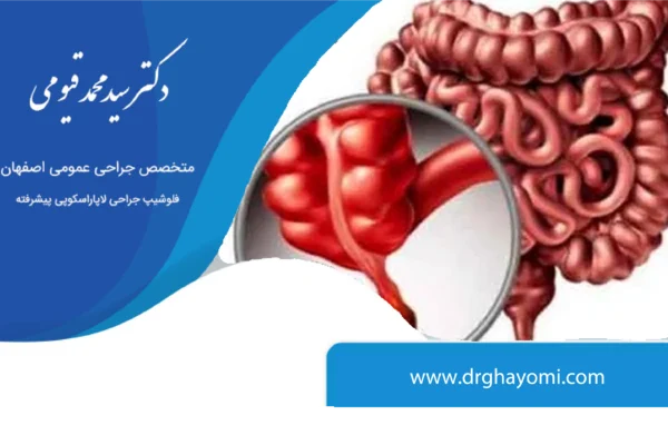 همیشگی جراحی آپاندیس