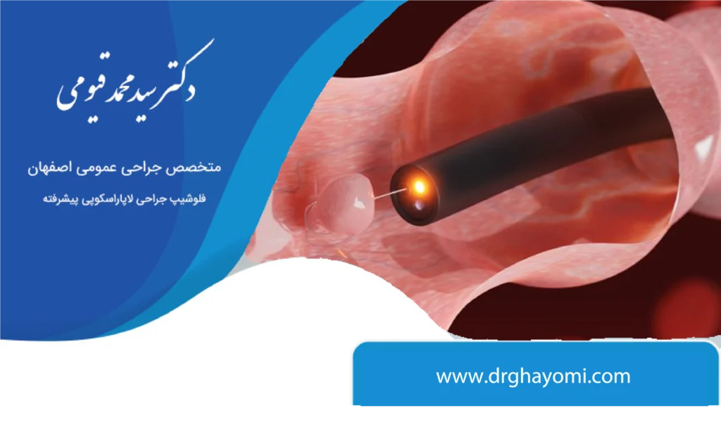 کولونوسکوپی و تشخیص سرطان