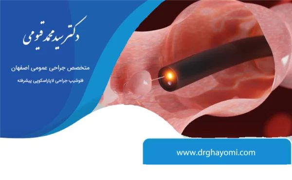 کولونوسکوپی و تشخیص سرطان