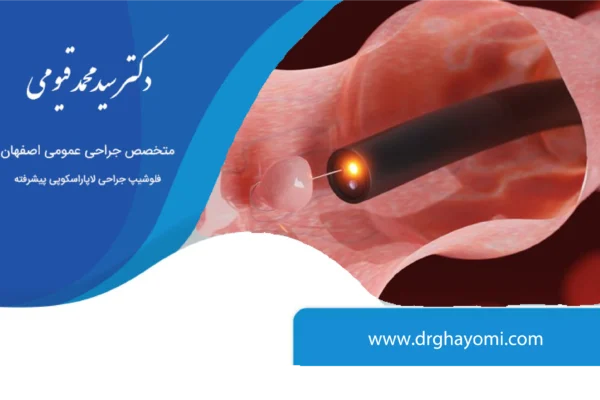 کولونوسکوپی و تشخیص سرطان
