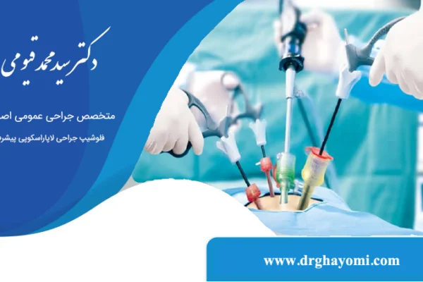 لاپاراسکوپی