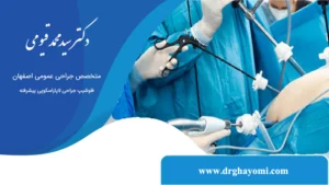لاپاراسکوپی