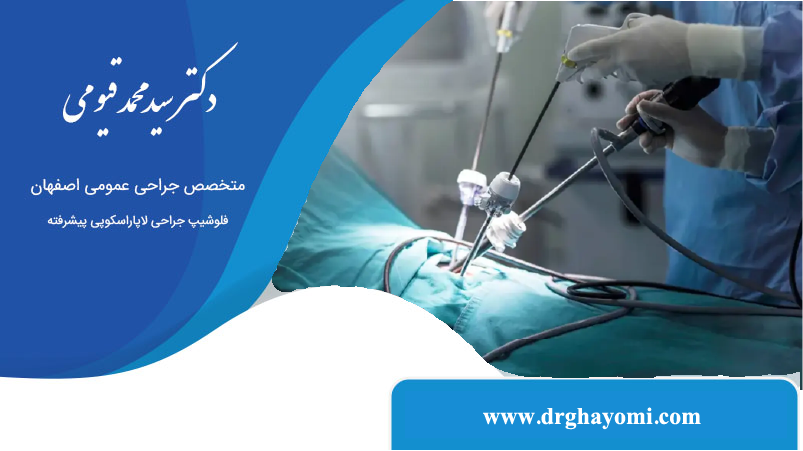 کاربرد لاپاراسکوپی
