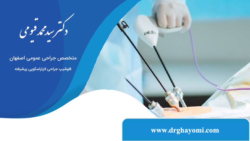 تفاوت لاپاراسکوپی با جراحی باز