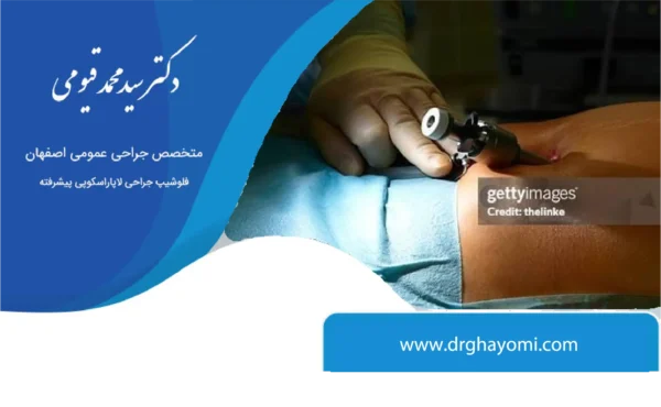 خطرات لاپاراسکوپی چیست