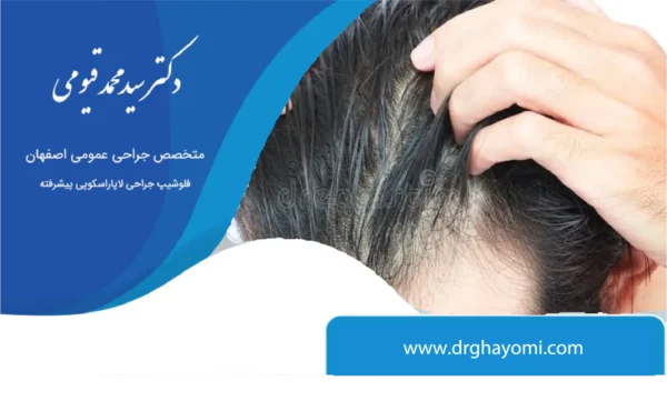 ریزش مو بعداز اسلیو