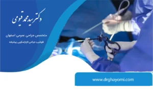 فتق اینگوینال